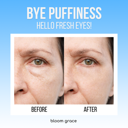 ACTIVE BLOOM® Under-Eye Therapy