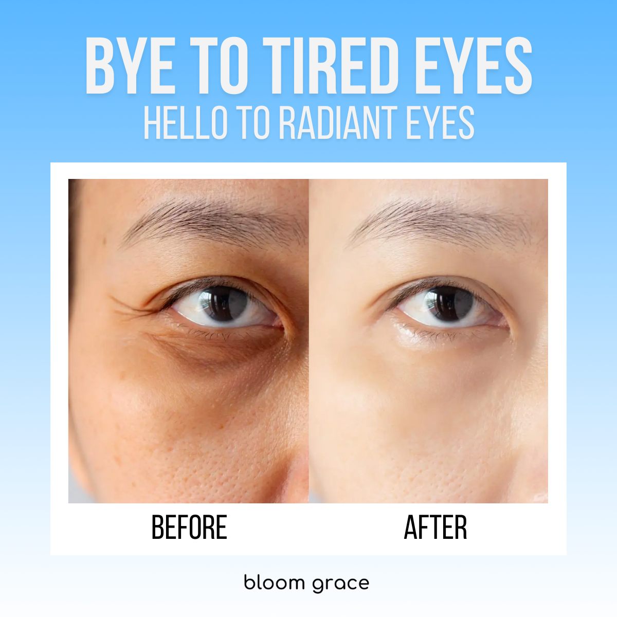 ACTIVE BLOOM® Under-Eye Therapy