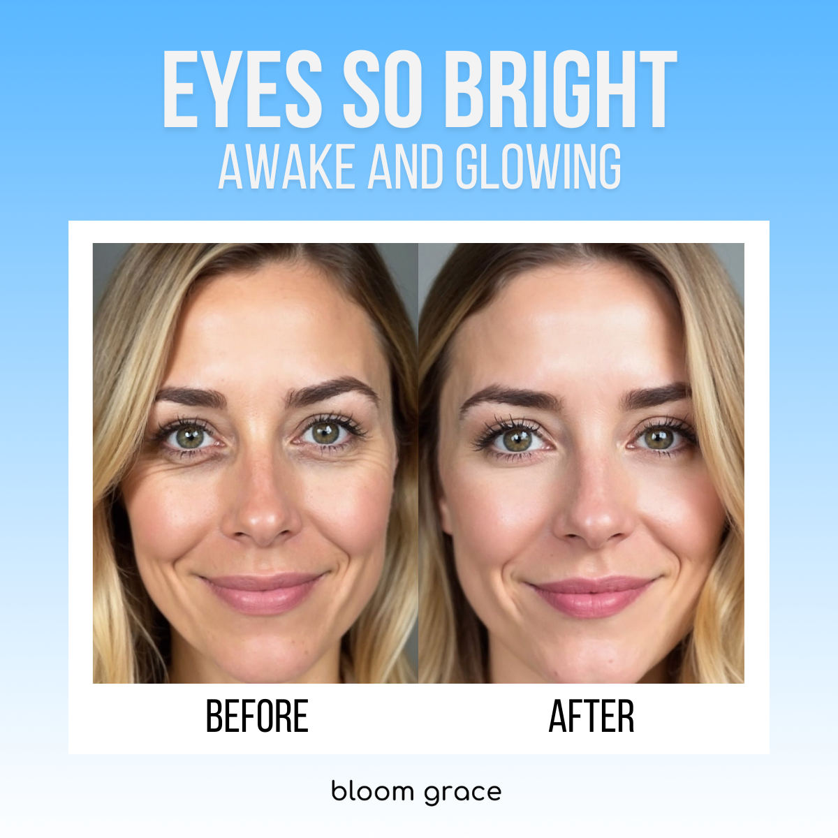 ACTIVE BLOOM® Under-Eye Therapy