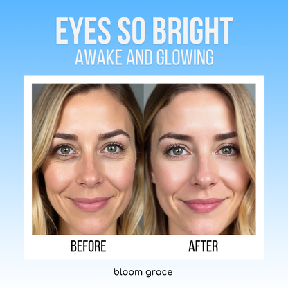 ACTIVE BLOOM® Under-Eye Therapy